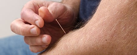 akupunktur-cta