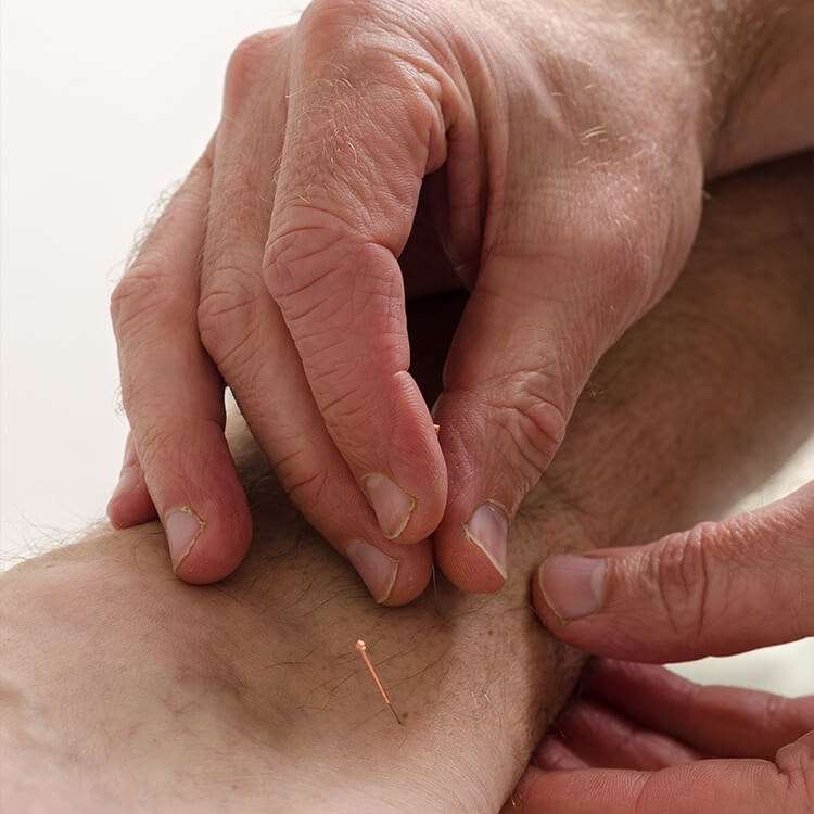 Skånsom akupunktur behandling hos Fysioterapi & akupunktur v/ Jakob Andreasen i Odense nær Ringe & Langeskov.